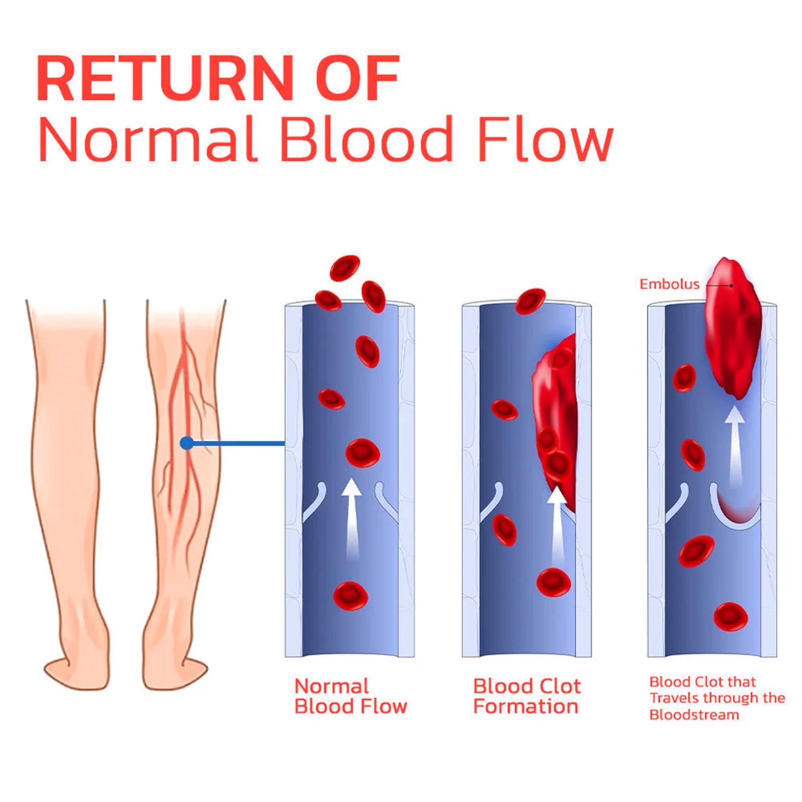 Arch Support, Anti-slip And Wear-resistant Body Care, Slimming And Body Shaping, Vein Repair Insoles